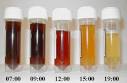 Liver pain and dark urine...