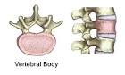 Vertebrae of the Spine - Cedars-