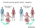X-linked recessive genetic defects - how girls are affected ...