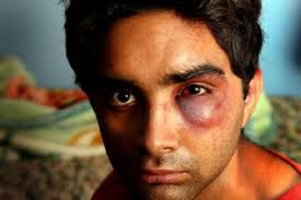 Sourabh Sharma ... beaten on a train. Photo: Penny Stephens. VIOLENT attacks against Indian people are on the rise in Sydney, forcing the Indian Government ... - srilankan_student-420x0
