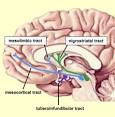 Study: Elderly People With Dementia Taking Antipsychotic Drugs Are ...