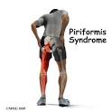 Sciatic Nerve Treatment