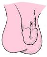 epispadias - definition of epispadias in the Medical dictionary ...