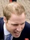 http://www.thewestminsterpractice.com/blog/wp-content/uploads/2011/04/prince-william-balding.jpg