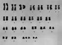 Chromosomes
