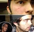 Guy Who Kid Cudi Punched