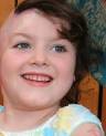 Hope for burns toddler Sophie - National - smh.