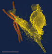 Immune system - Wikipedia, the free encyclopedia