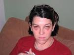 Red Eye Image