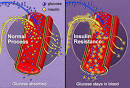 Diabetes Type 2 Symptoms | all