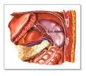 the spleen (<b>splenectomy</b>)
