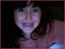 Noah gets braces!