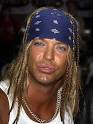 OMG! Bret Michaels Brain Hemmorhage