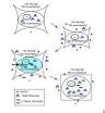 Hypernatremia