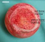 two types of <b>bone marrow</b>: