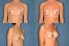 http://t1.gstatic.com/images?q=tbn:ANd9GcQjoKHuZOO9gB1RxmGqveV2CwJEhhe75MpTC9WLzlVMg27t9EzkFA