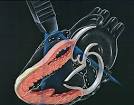 Echocardiogram