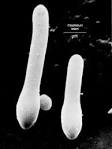 the growth of C. <b>tetani</b>.