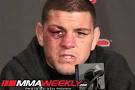 Nick Diaz Nominated as