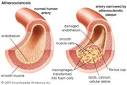 Prevention of Cardiovascular Disease ~ Medical Diagnosis and Treatment