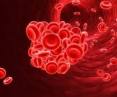 6 Blood Clotting Disorders You Should Know About | Health Watch Center