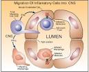 Multiple Sclerosis: Possible Etiologic Mechanisms of Demyelination ...