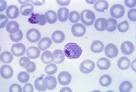 File:<b>Plasmodium vivax</b> 01.png