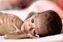 India: Rich man, starving child - 3695653522