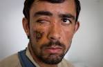 ... in Kajaki district of Helmand killing one and injuring 7 soldiers. - a19_20846175