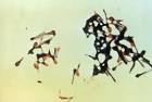 Clostridium <b>tetani</b>