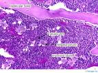 <b>Bone Marrow</b> 40x.