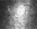 seen in the <b>endothelium</b>.