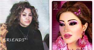 الفنانات قبل عملية التجميل ومن دون مكياج Images?q=tbn:ANd9GcQsn9HN4pyW4BdzPdknw3QGo5qII6ixPU3_CCd7wTuDgF5SqsVvdQ