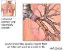 Acute Bronchitis | Nursing Crib