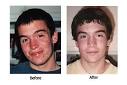  How to locate a Acne Home cure