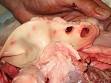 <b>Aorta</b> and pulmonary artery