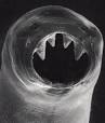 Hookworms for allergies? | Ari Salomon: Art and Design