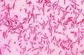 <b>borrelia burgdorferi</b>.