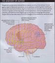 Autism Education Station - WHAT IS AUTISM?