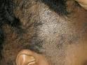 The dark side of relaxers Do you know what youre putting on your