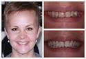 dentists edinburgh smile