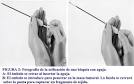<b>Biopsia</b>