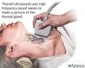 Thyroid cancer's risk is higher for diabetics new study shows ...