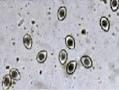 coccidia.jpg