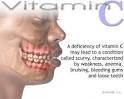 The New York Times > Health > Image > Vitamin C Deficit