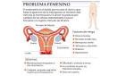 dicciomed.eusal.es <b>endometrio</b>