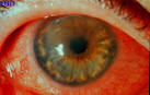 DJO | Digital Journal of Ophthalmology