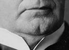 File:Cleft-Chin.jpg - Wikipedia, the free encyclopedia