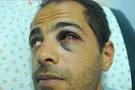 Mohammed Jaradat, journalist, in hospital (via imemc) - journalist_mohammed_jaradat_jepg