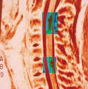 Ten top tips on multiple sclerosis   Pulse